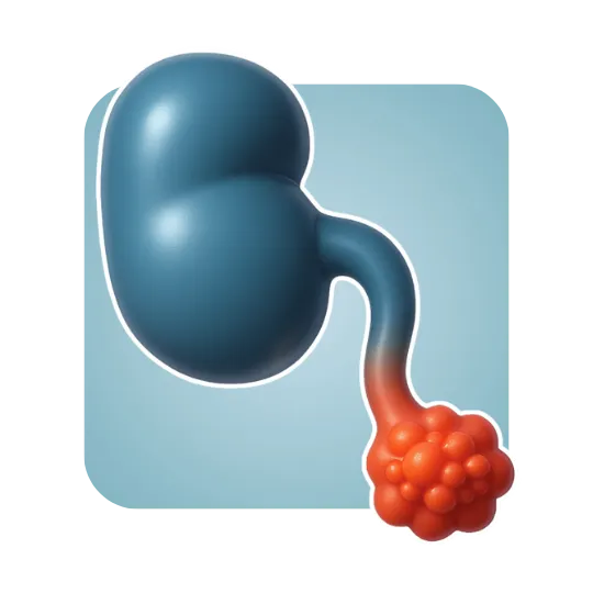 Appendix Cancer