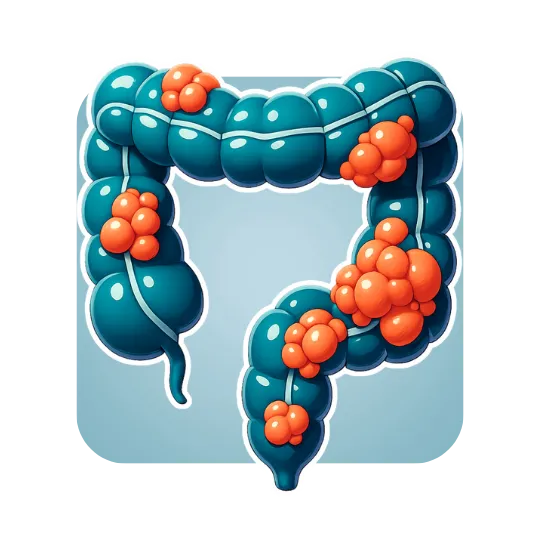 Colon Cancer