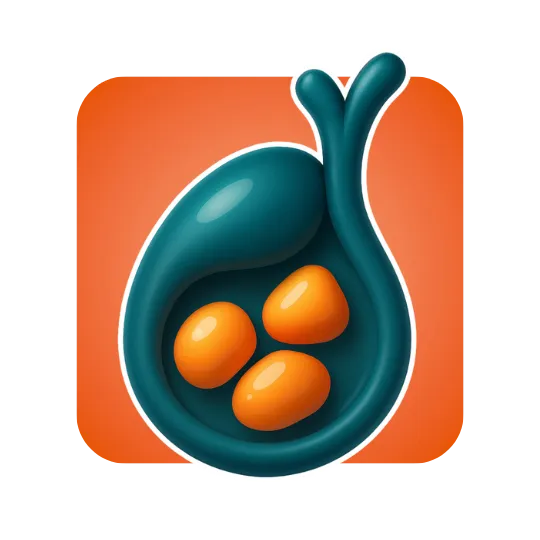 Gallbladder Cholesterol Stones