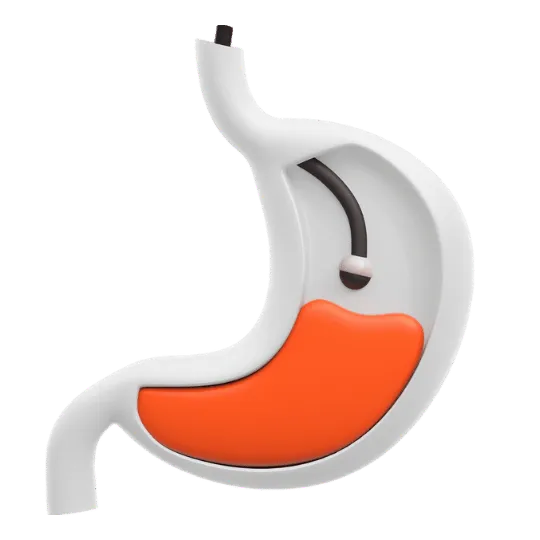 Know About What is Gastro Surgery - by Dr Harsh Shah