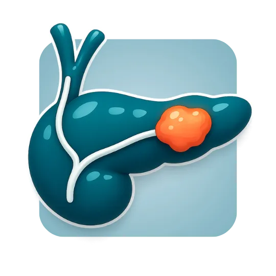 Pancreas Cancer 2