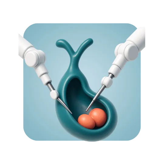 Robotic Cholecystectomy