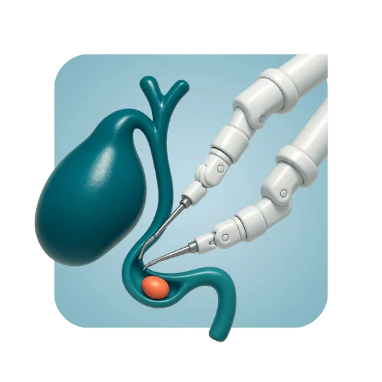 Robotic Common Bile Duct Exploration