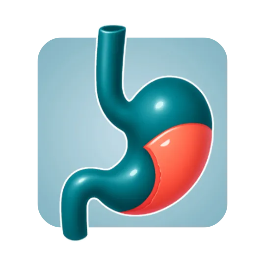 Robotic Gastrectomy