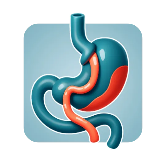Robotic Gastric Bypass