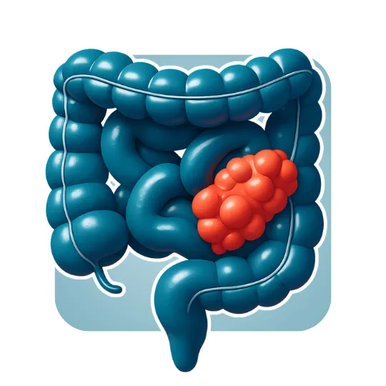 Small Intestine Cancer