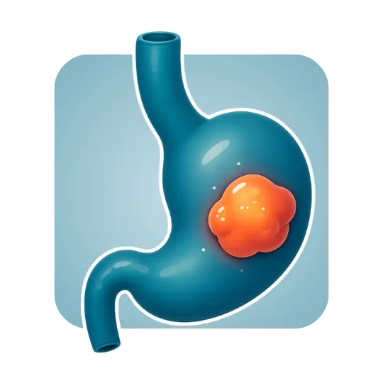 Stomach Cancer