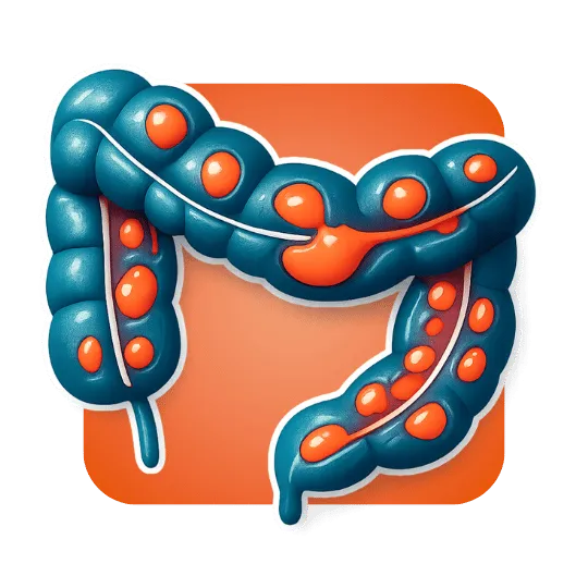 Ulcerative colitis Colon surgery to treat disease