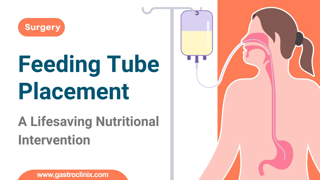Feeding Tube Placement