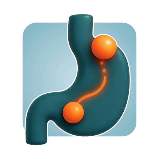 Hiatal Hernia–Associated Reflux