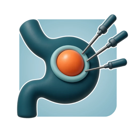 Laparoscopic Anti-Reflux Surgery