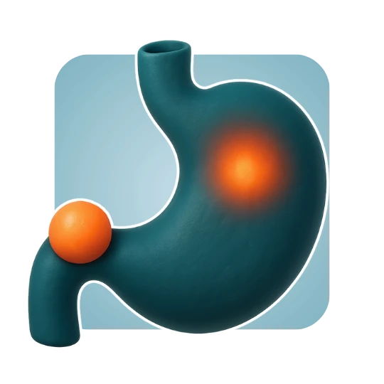 Post-Meal or Night-Time Reflux