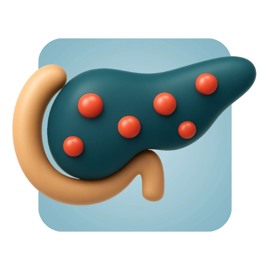 Recurrent Pancreatitis