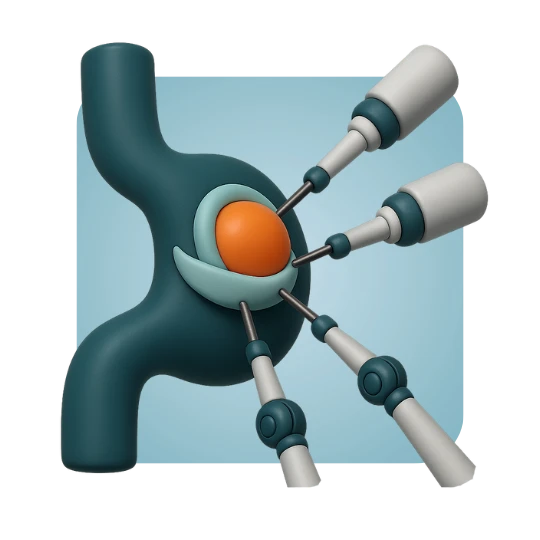 Robotic Fundoplication (Valve Strengthening)