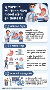 A Phase III Randomized Controlled Trial of Pyloroplasty Versus No Pyloroplasty in Patients Undergoing Minimally Invasive Esophagectomy DOI-10.1097SLA.0000000000006997