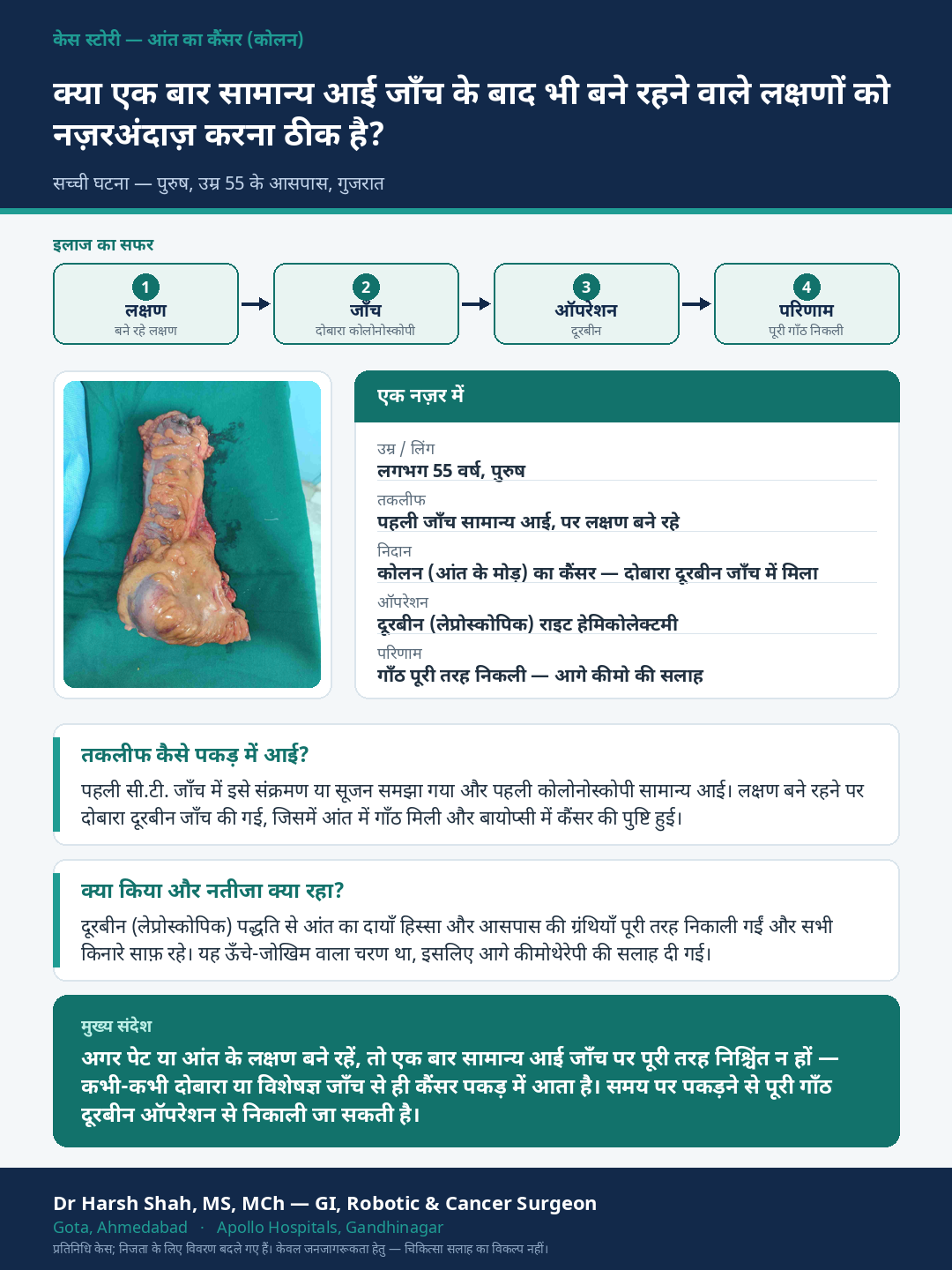 Colon Cancer patient case — Don't stop at one normal test — a cancer found on repeat colonoscopy. Dr Harsh Shah, GI & cancer surgeon, Ahmedabad.