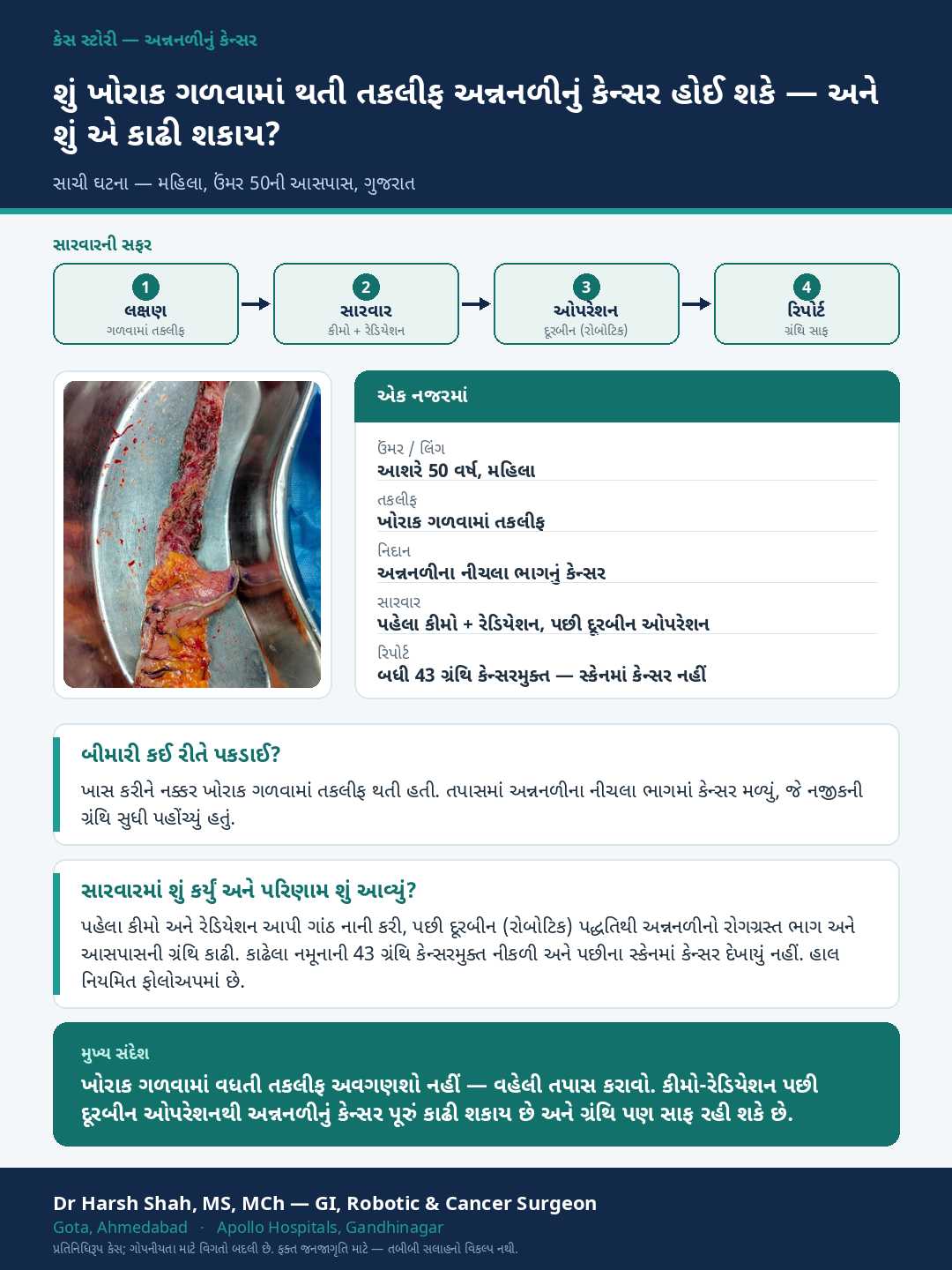 Esophageal (Food-pipe) Cancer patient case — Difficulty swallowing — treated with chemo-radiation and robotic surgery. Dr Harsh Shah, GI & cancer surgeon, Ahmedabad.
