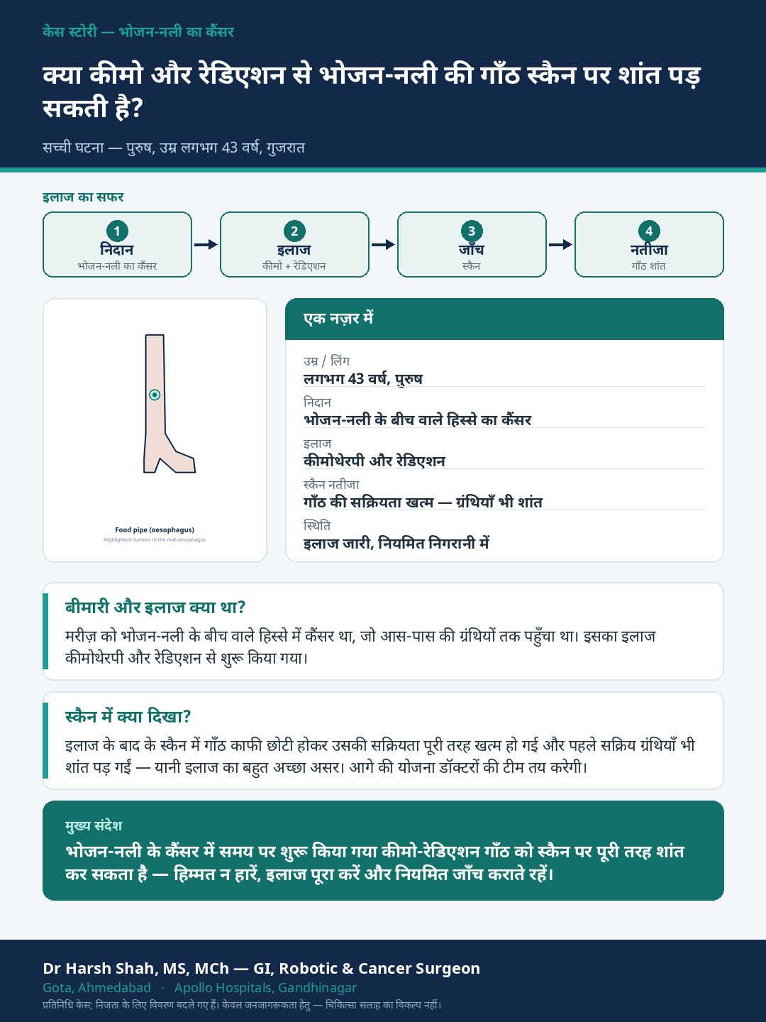 Esophageal (Food-pipe) Cancer patient case — A strong response to chemo-radiation seen on scan. Dr Harsh Shah, GI & cancer surgeon, Ahmedabad.