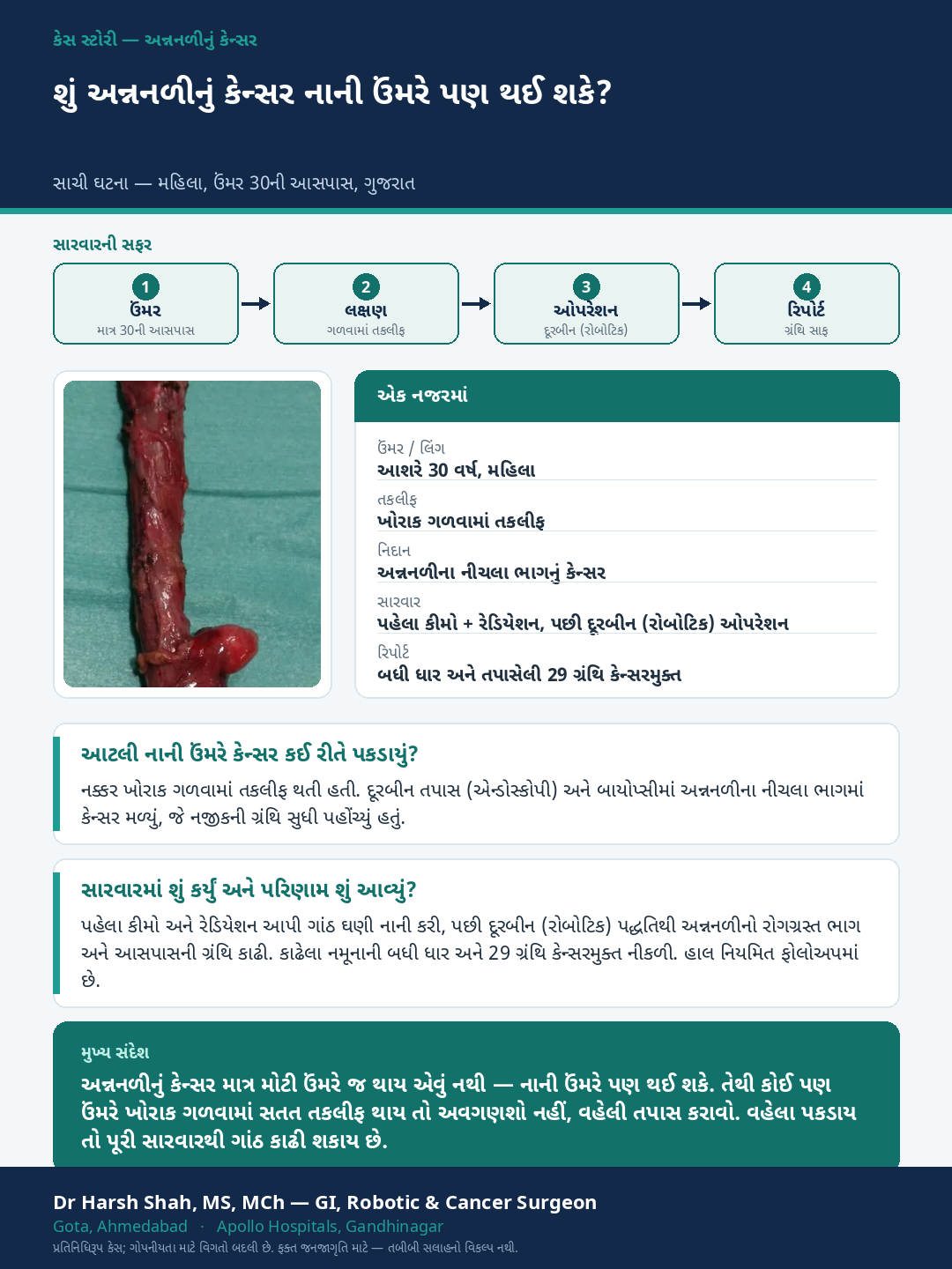 Esophageal (Food-pipe) Cancer patient case — Food-pipe cancer in a young patient. Dr Harsh Shah, GI & cancer surgeon, Ahmedabad.