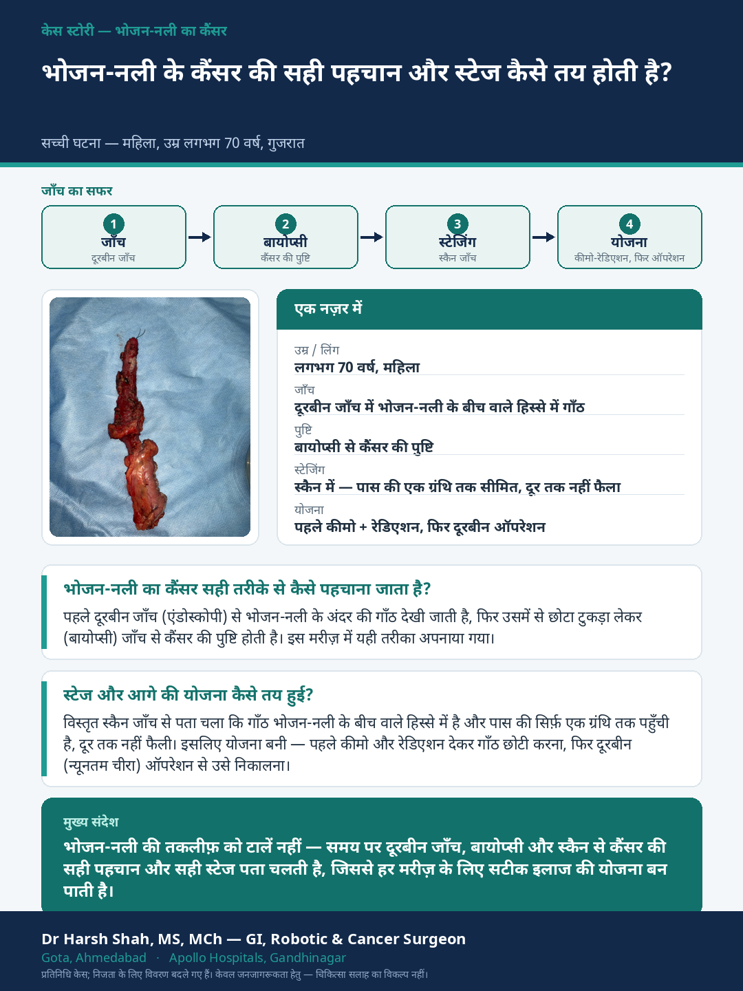 Esophageal (Food-pipe) Cancer patient case — How the diagnosis and stage are worked out. Dr Harsh Shah, GI & cancer surgeon, Ahmedabad.