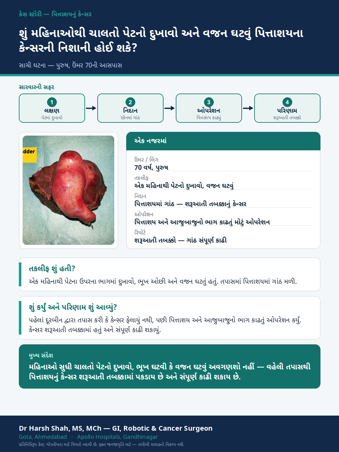 Gallbladder Cancer patient case — Months of pain and weight loss — caught as early-stage gallbladder cancer. Dr Harsh Shah, GI & cancer surgeon, Ahmedabad.
