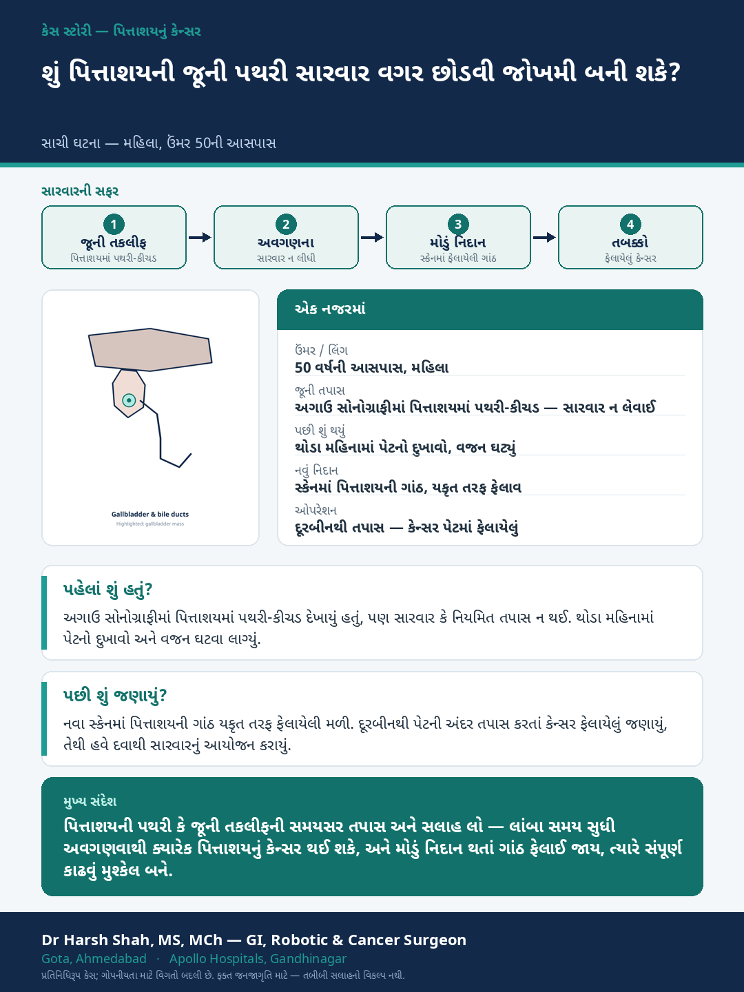 Gallbladder Cancer patient case — Neglected old gallstones presenting as advanced gallbladder cancer. Dr Harsh Shah, GI & cancer surgeon, Ahmedabad.