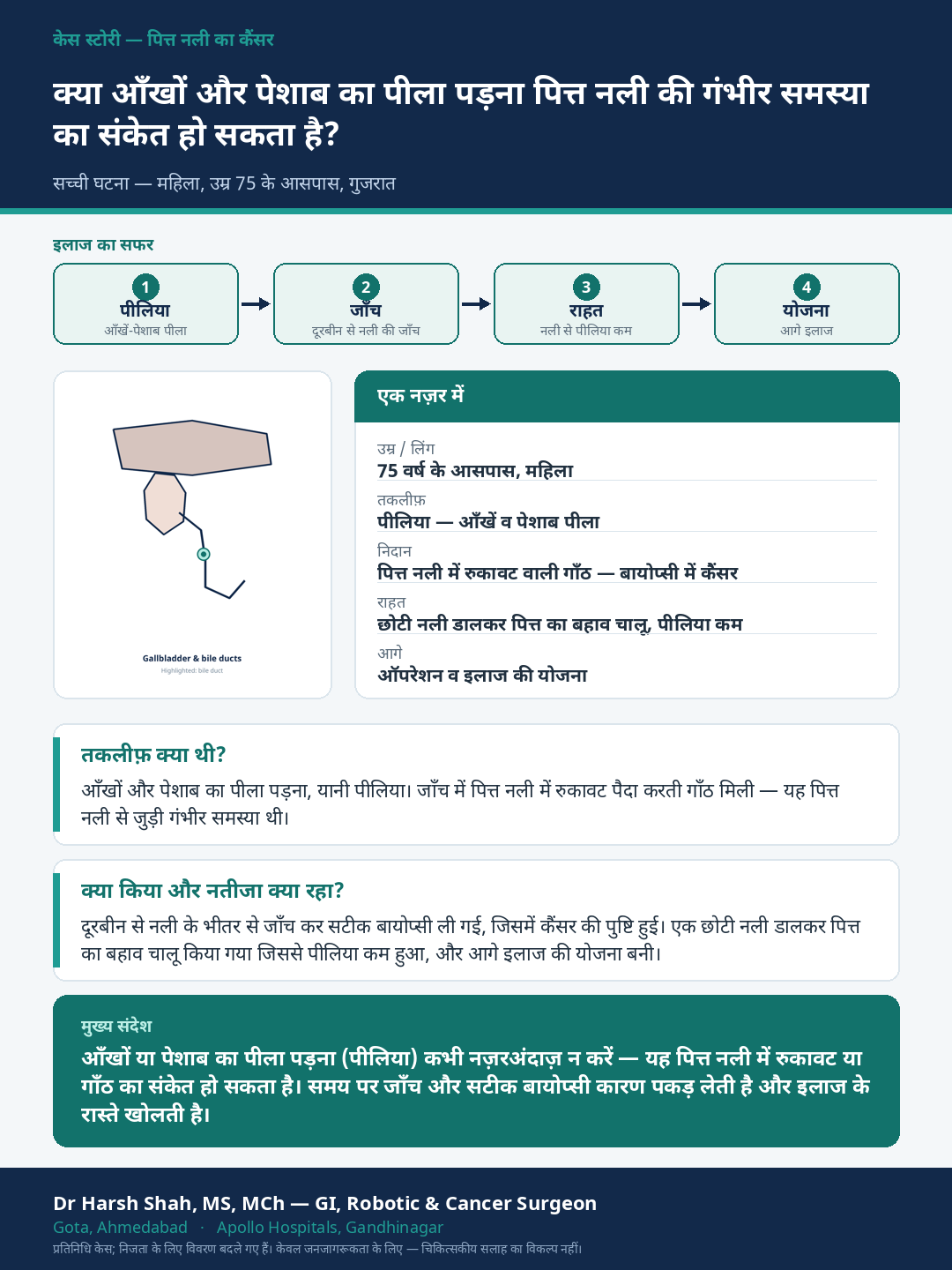 Gallbladder Cancer patient case — Yellow eyes and dark urine — a bile-duct cancer diagnosed precisely. Dr Harsh Shah, GI & cancer surgeon, Ahmedabad.