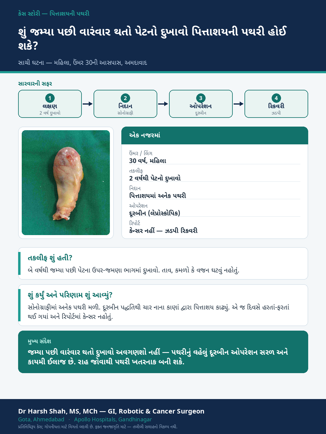 Gallstones patient case — Repeated pain after meals — gallstones treated by doorbeen surgery. Dr Harsh Shah, GI & cancer surgeon, Ahmedabad.