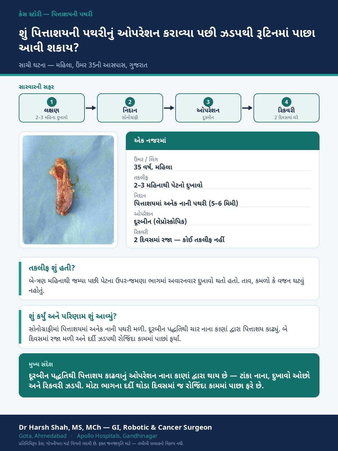 Gallstones patient case — Back to routine in days after doorbeen gallbladder removal. Dr Harsh Shah, GI & cancer surgeon, Ahmedabad.