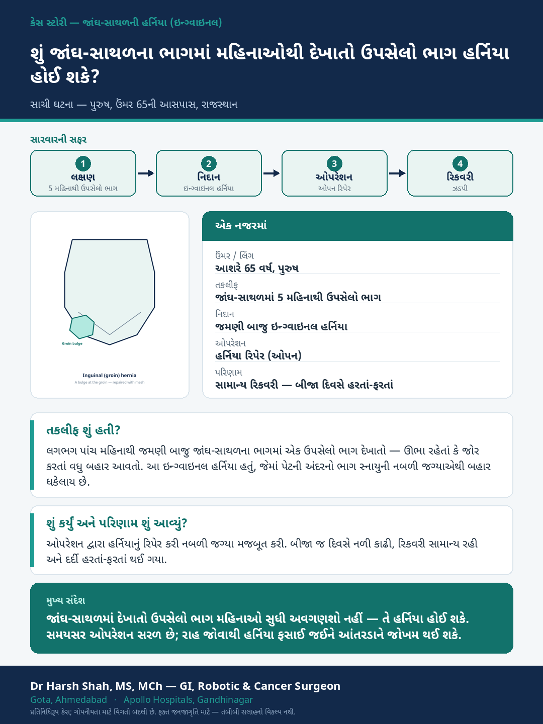 General GI Surgery patient case — A groin bulge for months — an inguinal hernia repaired. Dr Harsh Shah, GI & cancer surgeon, Ahmedabad.