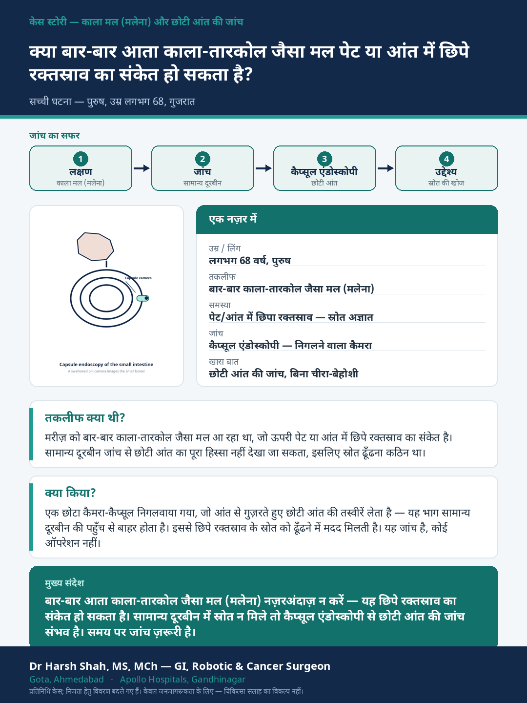 General GI Surgery patient case — Recurrent black stools — finding a hidden bleed with capsule endoscopy. Dr Harsh Shah, GI & cancer surgeon, Ahmedabad.