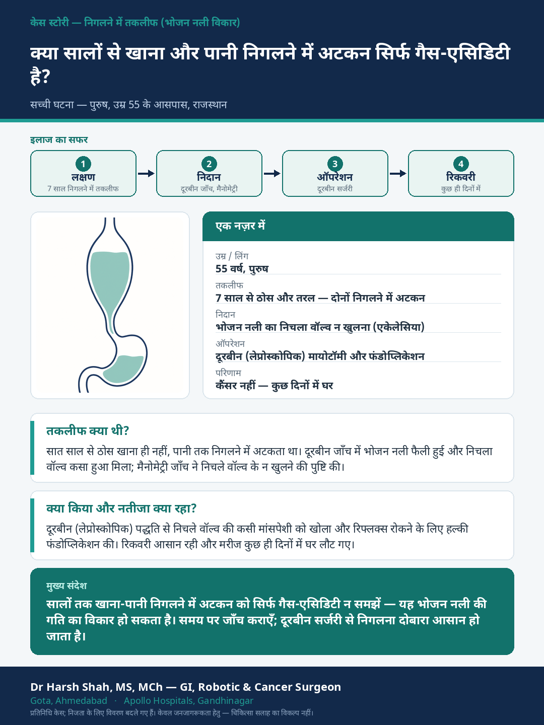 GERD & Swallowing Disorders patient case — Seven years of difficulty swallowing — achalasia treated by doorbeen surgery. Dr Harsh Shah, GI & cancer surgeon, Ahmedabad.