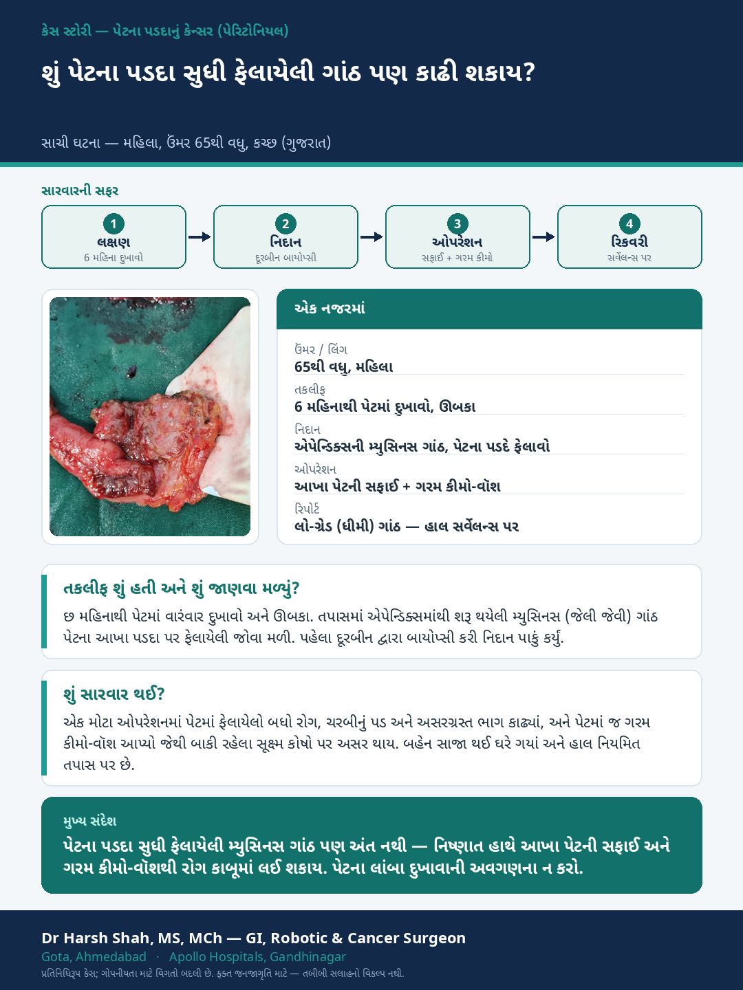 Peritoneal Surface Cancer & HIPEC patient case — Widespread mucinous disease treated with CRS and HIPEC. Dr Harsh Shah, GI & cancer surgeon, Ahmedabad.