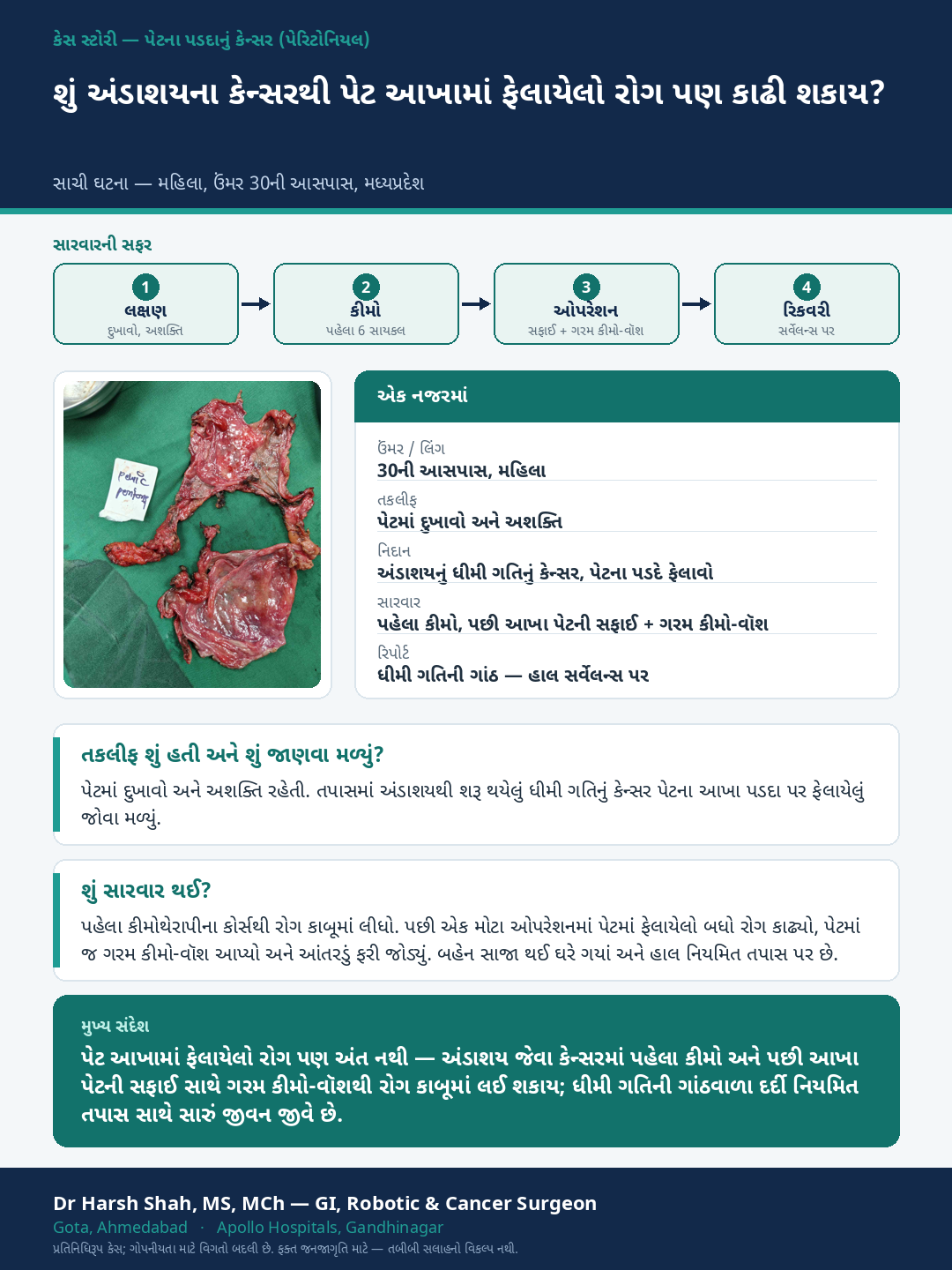 Peritoneal Surface Cancer & HIPEC patient case — Widespread ovarian disease removed with chemotherapy first. Dr Harsh Shah, GI & cancer surgeon, Ahmedabad.