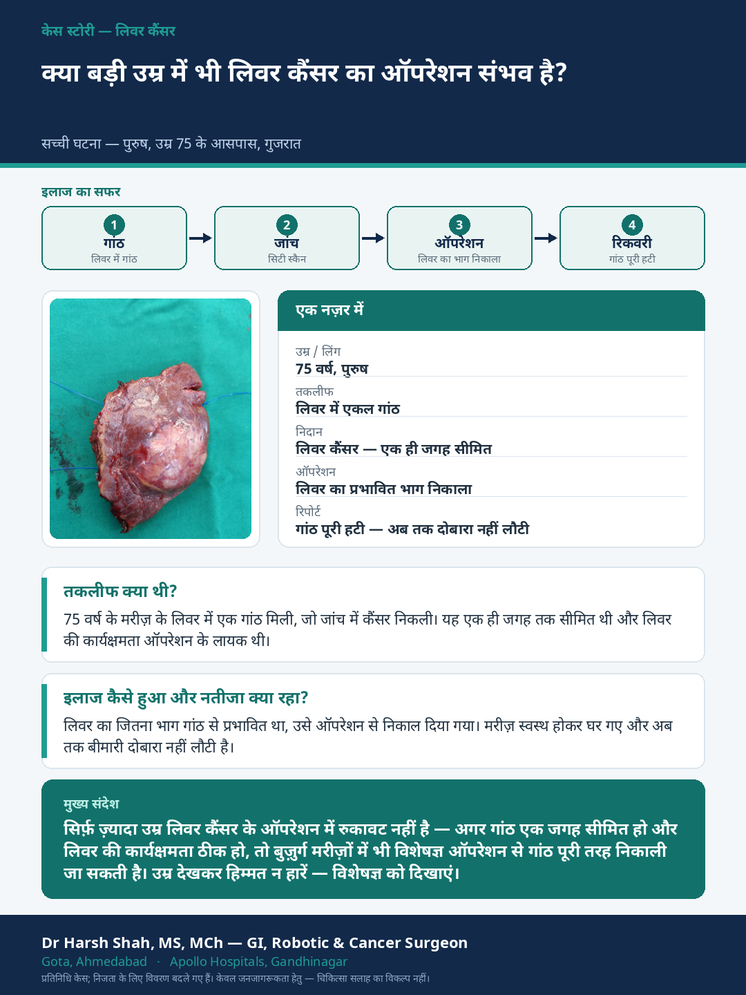 Liver Cancer patient case — Advanced age is not automatically a barrier. Dr Harsh Shah, GI & cancer surgeon, Ahmedabad.