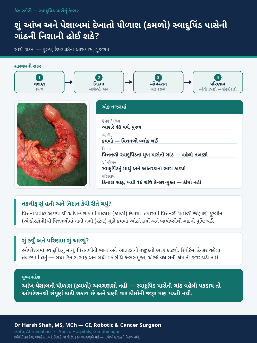 Pancreatic Cancer patient case — Jaundice leading to an early, curable tumour. Dr Harsh Shah, GI & cancer surgeon, Ahmedabad.