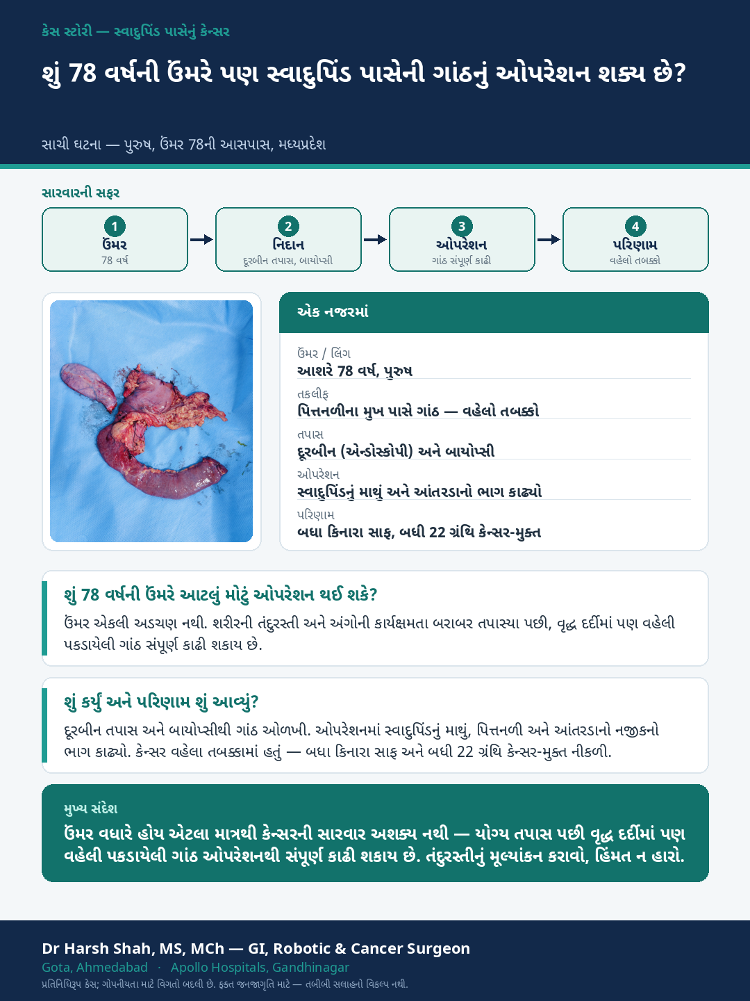Pancreatic Cancer patient case — An early tumour removed in an elderly patient. Dr Harsh Shah, GI & cancer surgeon, Ahmedabad.