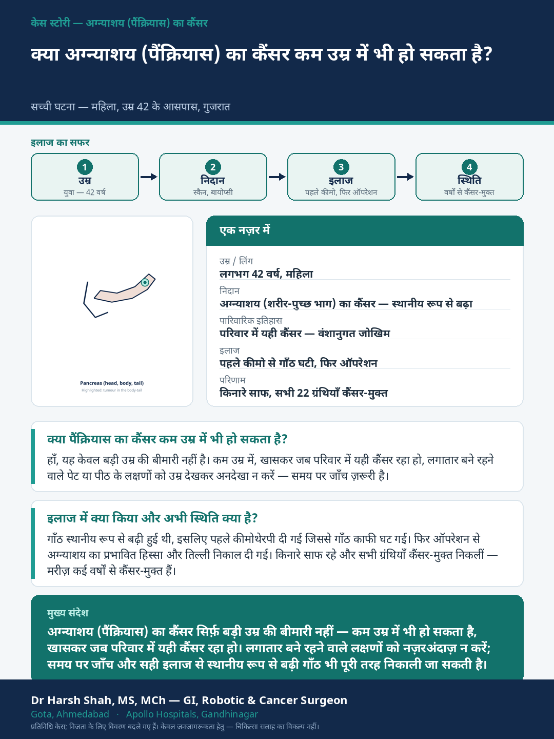 Pancreatic Cancer patient case — Pancreatic cancer in a young patient with a family history. Dr Harsh Shah, GI & cancer surgeon, Ahmedabad.
