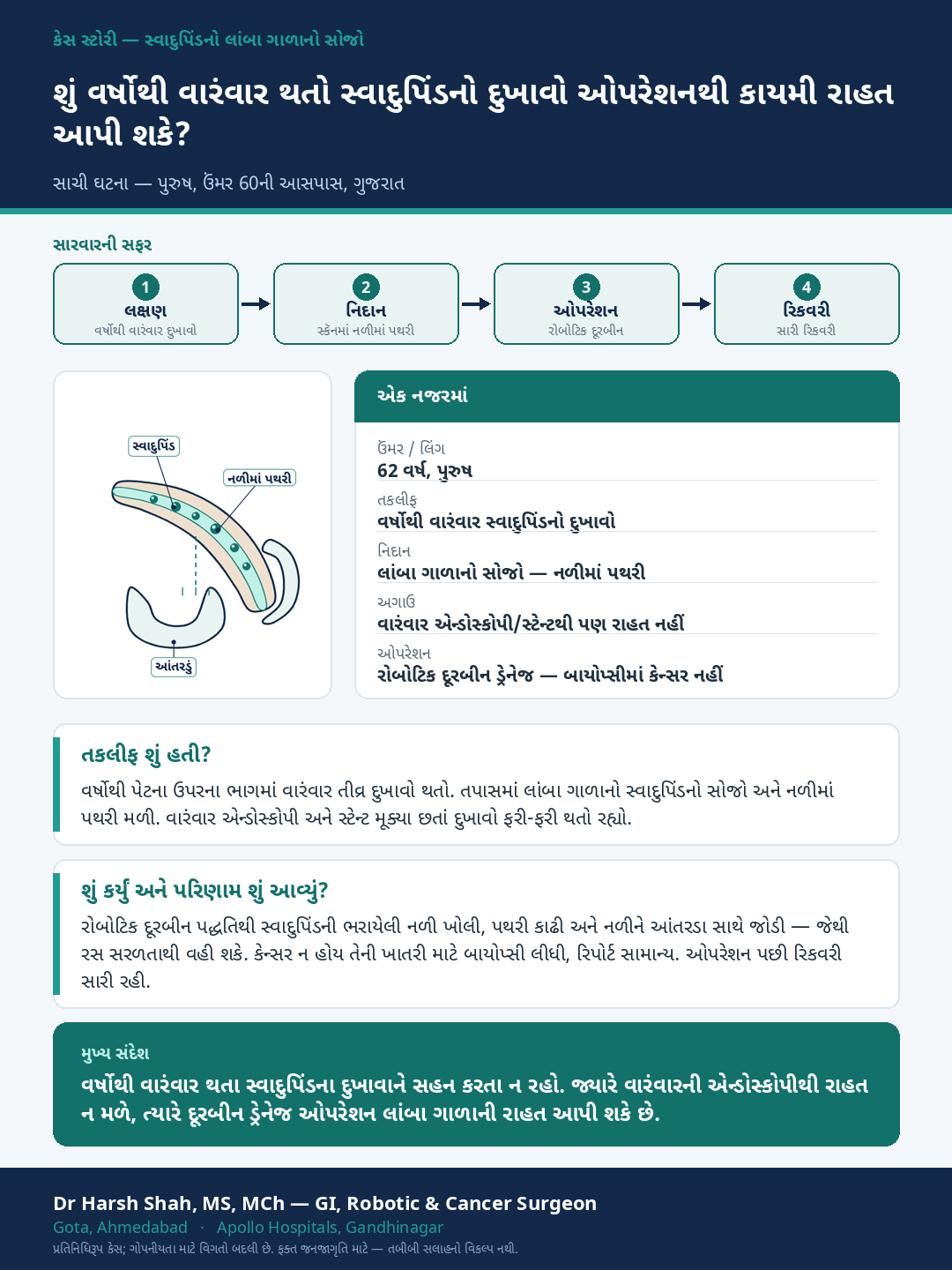 Pancreatitis patient case — Years of pain when endoscopy did not help — drainage surgery for relief. Dr Harsh Shah, GI & cancer surgeon, Ahmedabad.