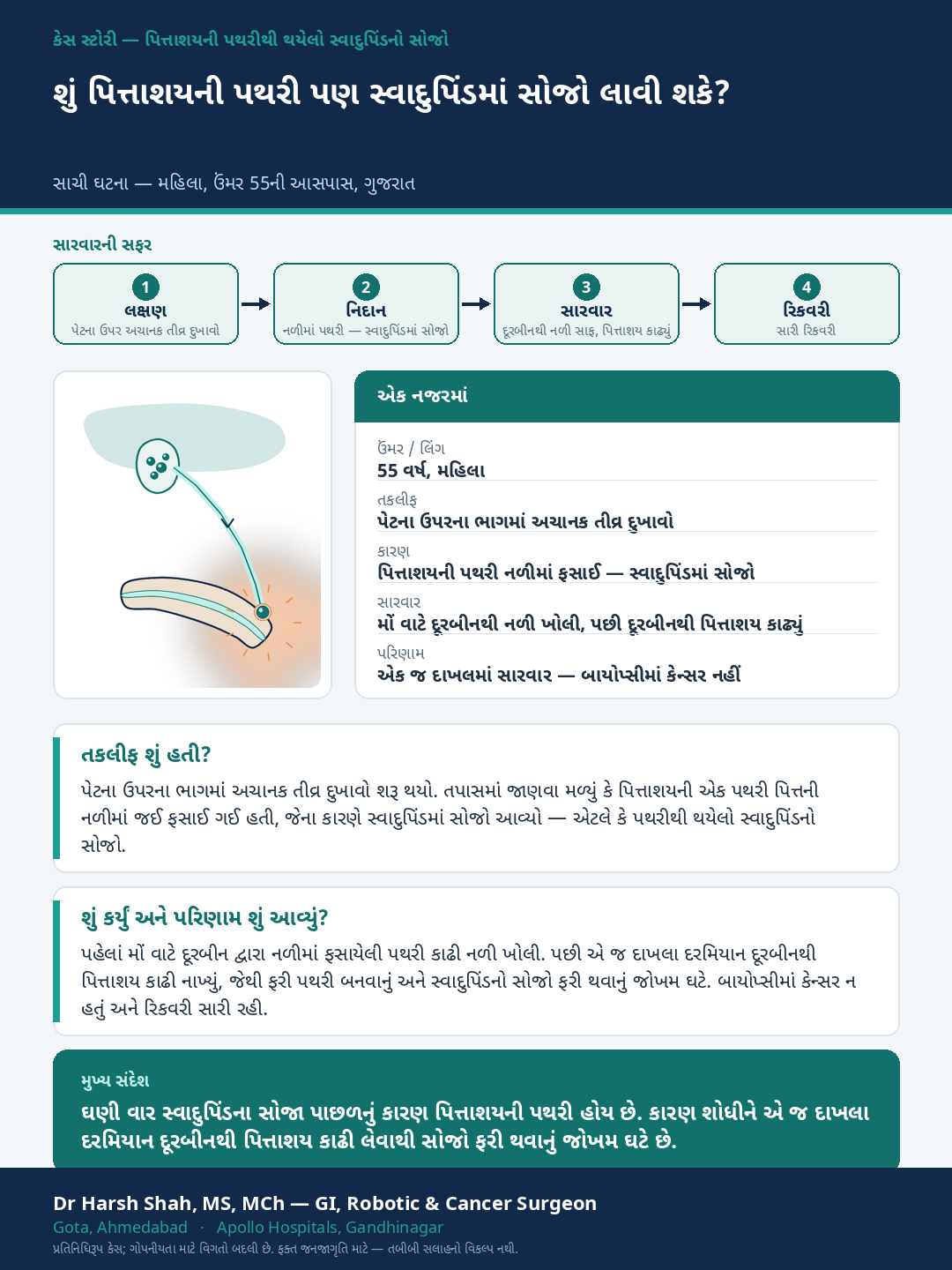 Pancreatitis patient case — Gallstone-triggered pancreatitis — treating the cause. Dr Harsh Shah, GI & cancer surgeon, Ahmedabad.