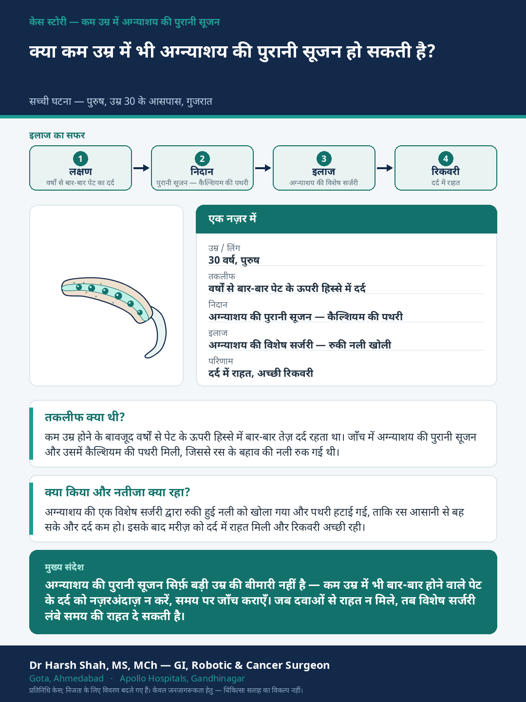 Pancreatitis patient case — Chronic pancreatitis at a young age. Dr Harsh Shah, GI & cancer surgeon, Ahmedabad.