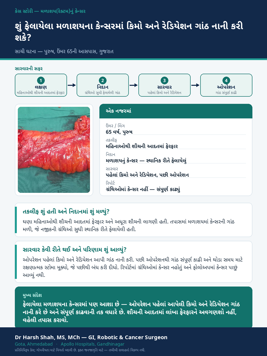 Rectal Cancer patient case — Locally advanced rectal cancer shrunk before surgery. Dr Harsh Shah, GI & cancer surgeon, Ahmedabad.