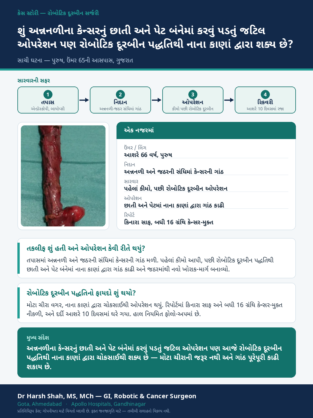 Robotic Cancer Surgery patient case — A complex food-pipe operation across chest and abdomen — done robotically. Dr Harsh Shah, GI & cancer surgeon, Ahmedabad.