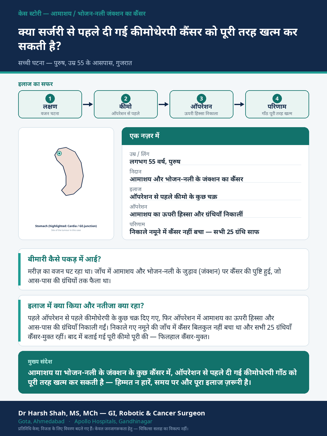 Stomach Cancer patient case — Chemotherapy before surgery that cleared the tumour. Dr Harsh Shah, GI & cancer surgeon, Ahmedabad.