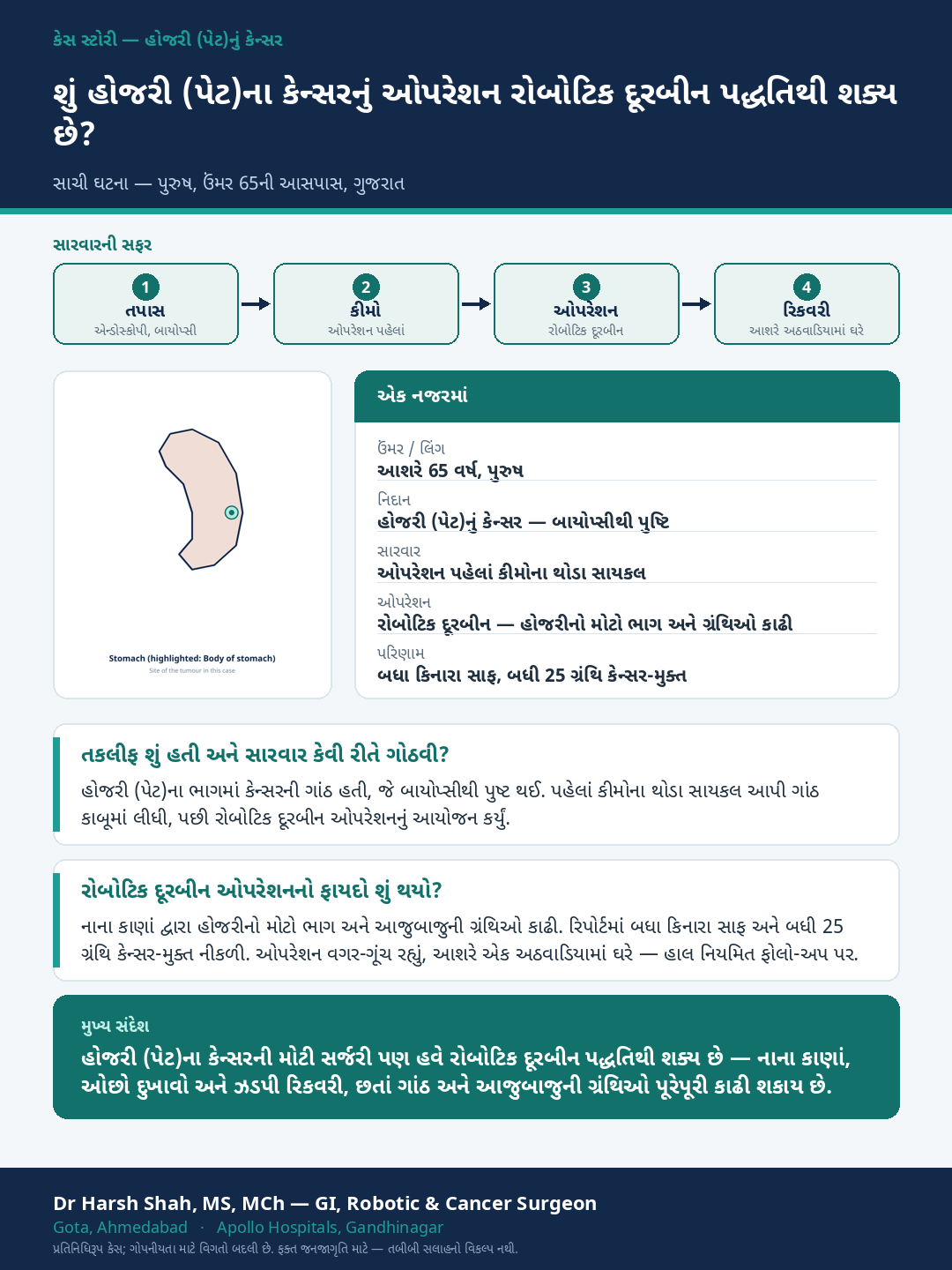 Stomach Cancer patient case — Robotic (doorbeen) stomach cancer surgery. Dr Harsh Shah, GI & cancer surgeon, Ahmedabad.