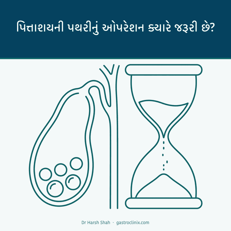 પિત્તાશયની પથરીનું ઓપરેશન ક્યારે જરૂરી છે? 5 પિત્તાશયની પથરી અને રેતઘડિયાળ — ઓપરેશન ક્યારે જરૂરી છે