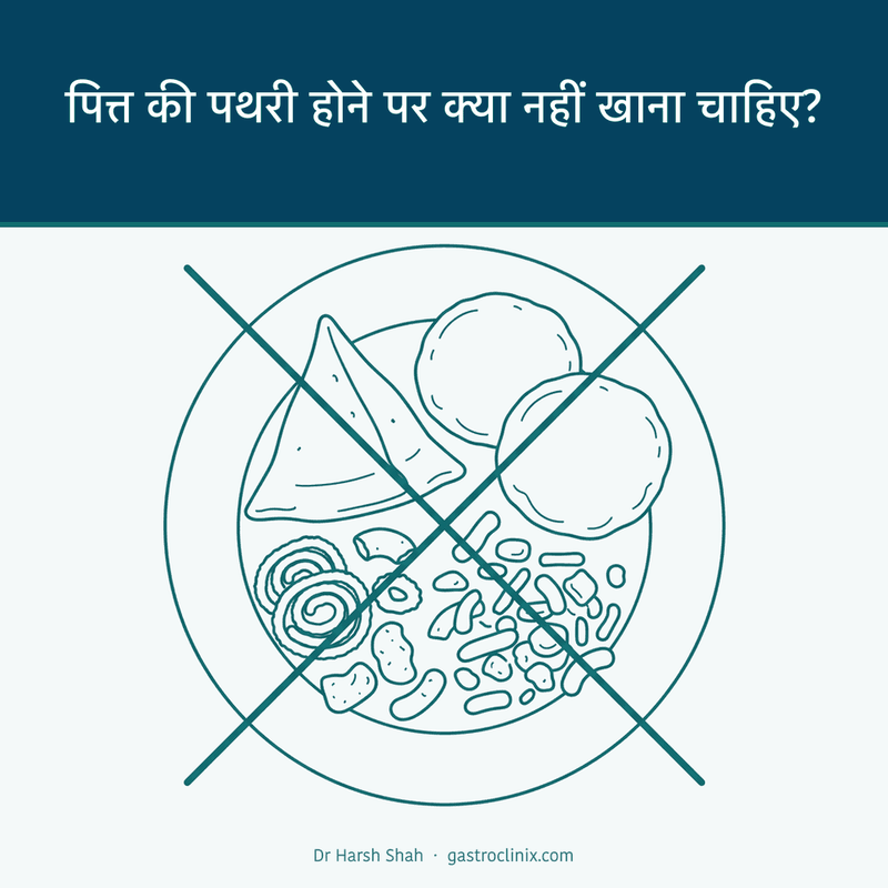 तली-भुनी चीज़ों की थाली पर काटा हुआ निशान — पित्त की पथरी में क्या नहीं खाना चाहिए