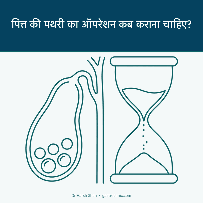 पित्त की पथरी वाली पित्ताशय की थैली और रेत घड़ी — ऑपरेशन का सही समय