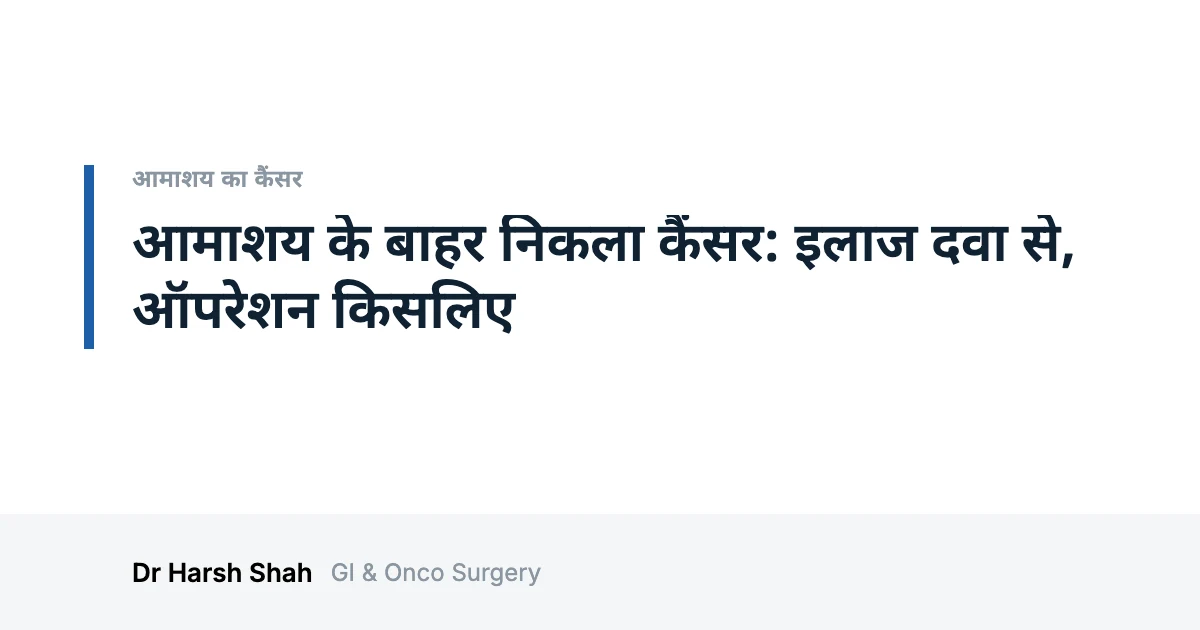 Dr. Harsh Shah - Best Doctor For Cancer Treatment in Ahmedabad 36 आमाशय के बाहर निकला कैंसर: इलाज दवा से, ऑपरेशन किसलिए