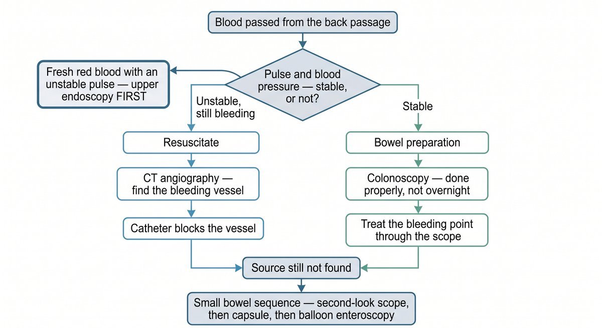 Flowchart: blood from the back passage is managed by checking whether pulse and blood pressure are stable, then colonoscopy or CT angiography, then small bowel tests if no source is found.